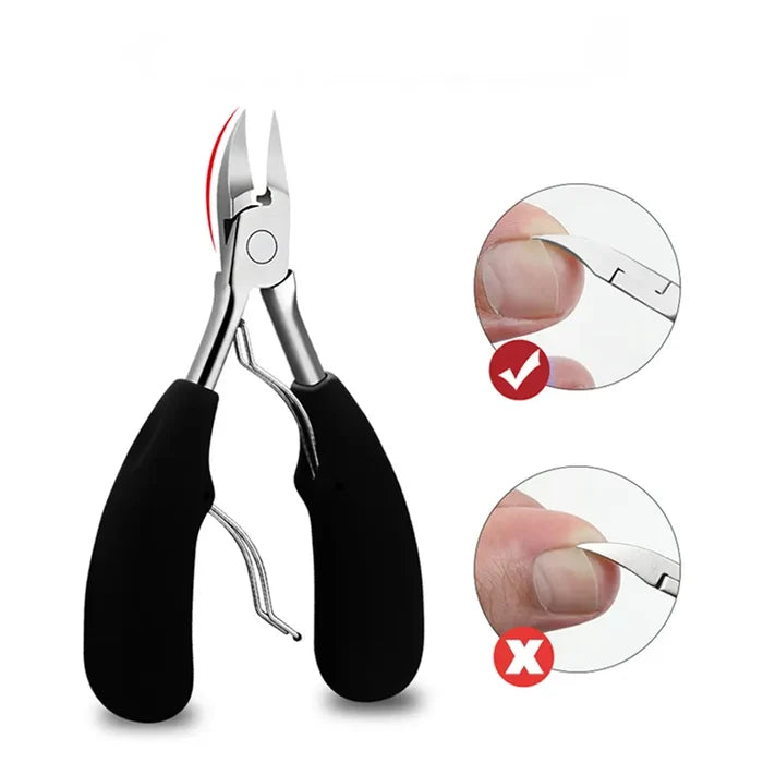 5pc Ingrown Toe Nail Set