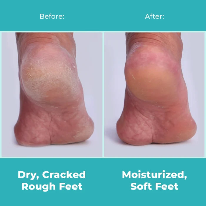 i-Spa Heel Peel Online Course