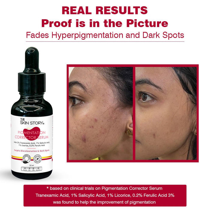 Anti - Pigmentation Serum & Sunscreen - The Skin Story - Face Care