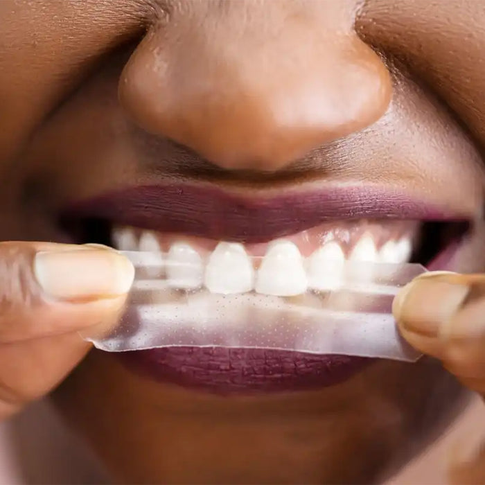Non-Slip Teeth Whitening Strips - Iconic White