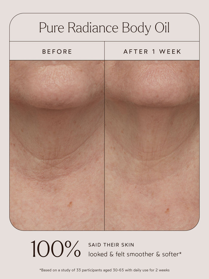 Comparison of neck skin texture before and after one week of using Pure Radiance Body Oil | True Botanicals, showing visibly smoother and softer skin.