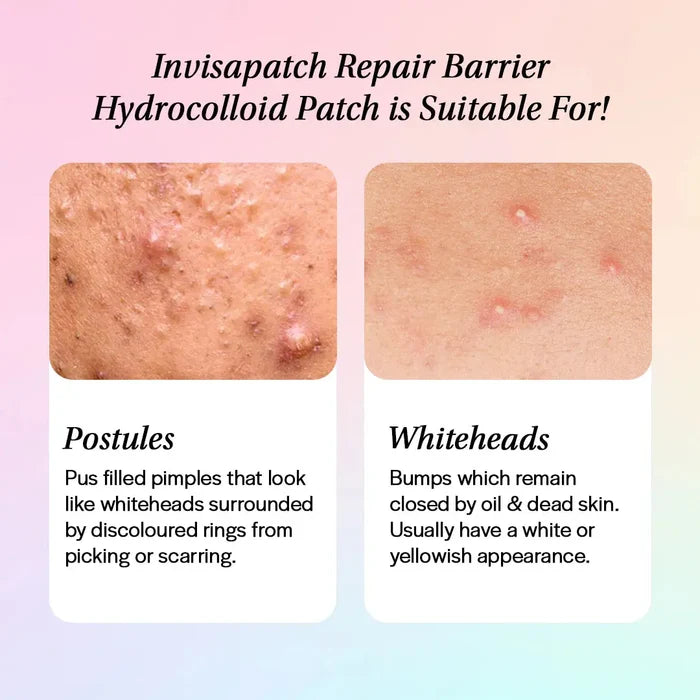 The Superdots Invisapatch Repair Barrier Hydrocolloid Spot Patch The Superdots