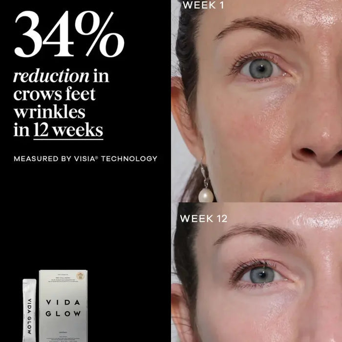 Vida Glow Pro Collagen+ Vida Glow